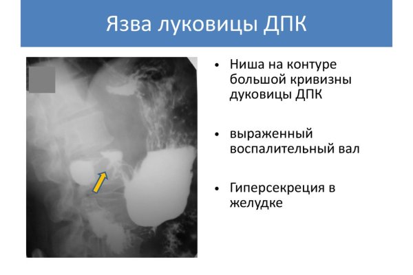 Открыть даркнет